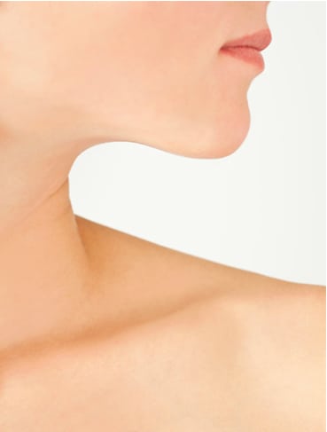 neckilift procedure