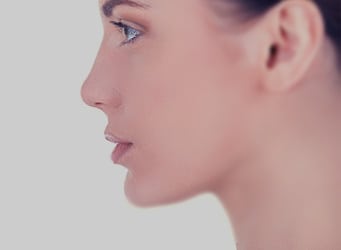 Rhinoplasty Yu San Antonio Facial Plastic Surgery